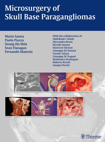 Cover for Mario Sanna · Microsurgery of Skull Base Paragangliomas (Hardcover Book) (2013)