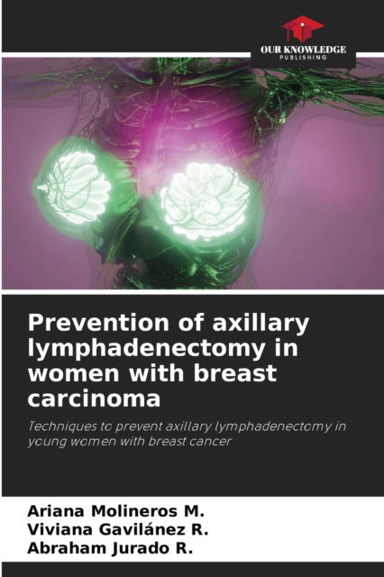 Cover for Ariana Molineros M · Prevention of axillary lymphadenectomy in women with breast carcinoma (Paperback Book) (2021)
