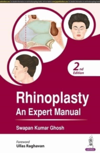 Cover for Swapan Kumar Ghosh · Rhinoplasty: An Expert Manual (Paperback Book) [2 Revised edition] (2024)