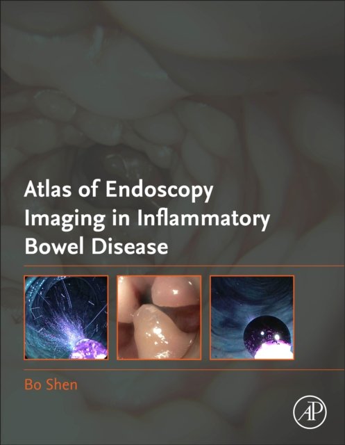 Cover for Bo Shen · Atlas of Endoscopy Imaging in Inflammatory Bowel Disease (Innbunden bok) (2020)