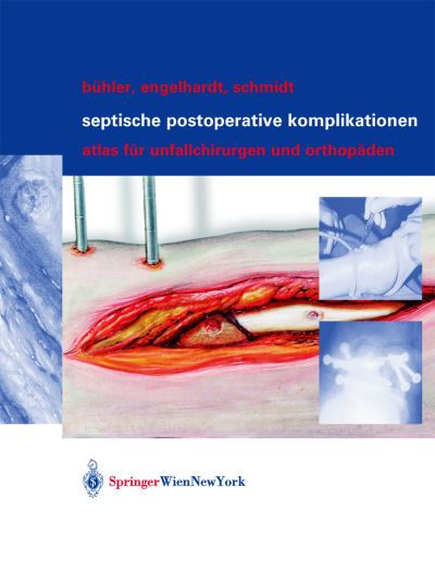 Cover for Matthias Buhler · Septische Postoperative Komplikationen: Atlas Fur Unfallchirurgen Und Orthopaden (Hardcover Book) [2003 edition] (2003)