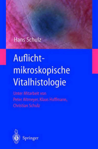 Cover for Hans Schulz · Auflichtmikroskopische Vitalhistologie: Dermatologischer Leitfaden (Hardcover Book) [German, 1 edition] (2001)