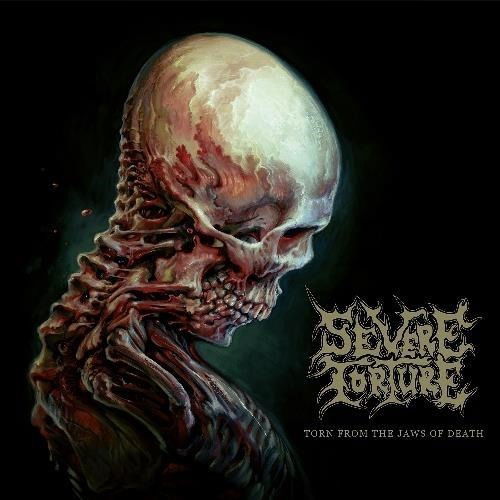 Torn from the Jaws of Death (Ltd.digi) - Severe Torture - Music - SEASON OF MIST - 0822603000115 - June 7, 2024