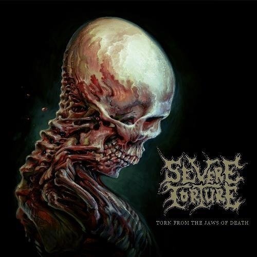 Cover for Severe Torture · Torn from the Jaws of Death (CD) (2024)