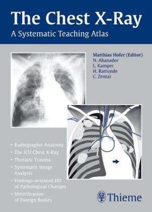 Cover for Matthias Hofer · The Chest X-Ray: A Systematic Teaching Atlas (Pocketbok) (2006)