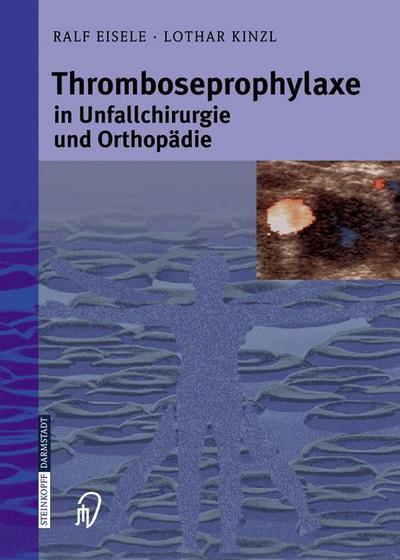 Cover for Ralf Eisele · Thromboseprophylaxe in Unfallchirurgie Und Orthopadie (Book) [2006 edition] (2005)