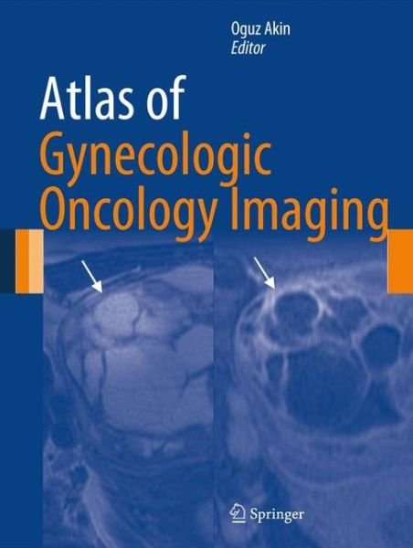 Cover for Oguz Akin · Atlas of Gynecologic Oncology Imaging - Atlas of Oncology Imaging (Hardcover Book) [2014 edition] (2013)