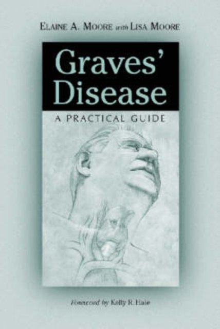 Cover for Elaine A. Moore · Graves' Disease: A Practical Guide (Paperback Book) (2001)