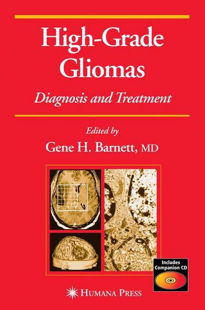 Cover for Gene H Barnett · High-Grade Gliomas: Diagnosis and Treatment - Current Clinical Oncology (Hardcover Book) [2007 edition] (2006)