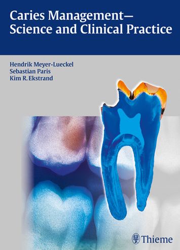 Cover for Meyer-Lückel Hendrik · Caries Management - Science and Clinical Practice (Hardcover Book) (2013)