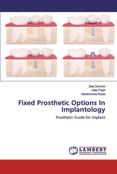 Cover for Somani · Fixed Prosthetic Options In Impl (Book) (2020)