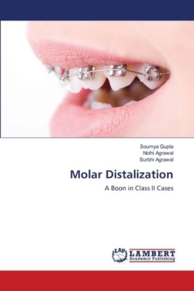 Molar Distalization - Gupta - Inne -  - 9786203195118 - 13 stycznia 2021