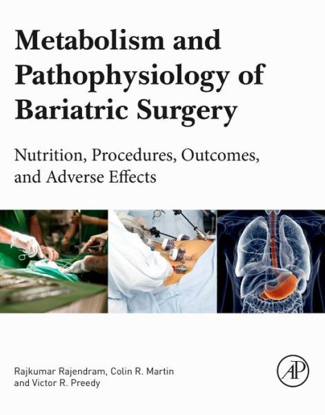 Cover for Rajkumar Rajendram · Metabolism and Pathophysiology of Bariatric Surgery: Nutrition, Procedures, Outcomes and Adverse Effects (Paperback Bog) (2016)