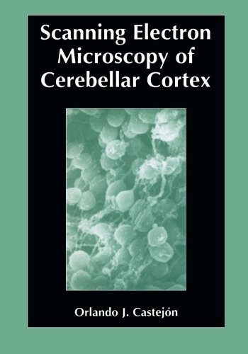 Cover for Orlando Castejon · Scanning Electron Microscopy of Cerebellar Cortex (Paperback Book) [Softcover reprint of the original 1st ed. 2003 edition] (2003)