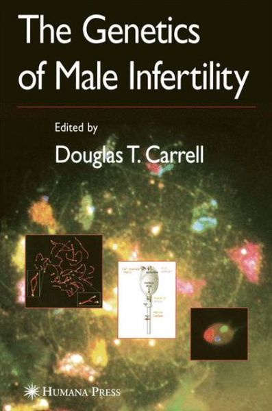 Cover for The Genetics of Male Infertility (Paperback Book) [1st ed. Softcover of orig. ed. 2007 edition] (2011)