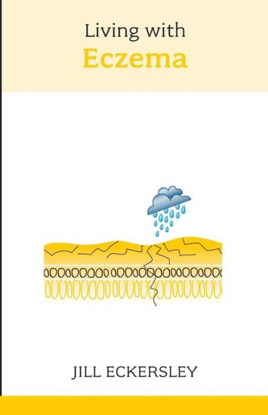 Cover for Jill Eckersley · Living with Eczema (Paperback Book) (2007)