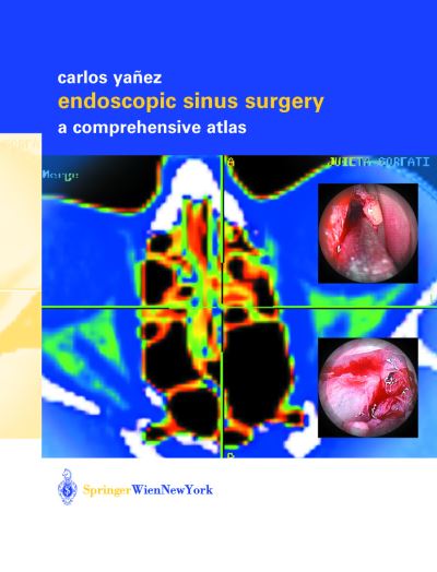 Cover for Carlos Yanez · Endoscopic Sinus Surgery: A Comprehensive Atlas (Hardcover Book) [2003 edition] (2002)