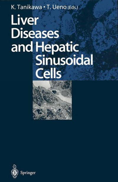 Cover for Kyuichi Tanikawa · Liver Diseases and Hepatic Sinusoidal Cells (Pocketbok) [Softcover reprint of the original 1st ed. 1999 edition] (2013)