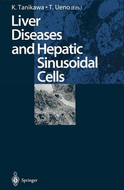 Kyuichi Tanikawa · Liver Diseases and Hepatic Sinusoidal Cells (Paperback Bog) [Softcover reprint of the original 1st ed. 1999 edition] (2013)