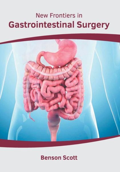 Cover for Benson Scott · New Frontiers in Gastrointestinal Surgery (Hardcover Book) (2019)