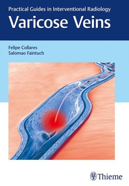 Varicose Veins: Practical Guides in Interventional Radiology - Felipe Collares - Boeken - Thieme Medical Publishers Inc - 9781626230125 - 16 augustus 2017