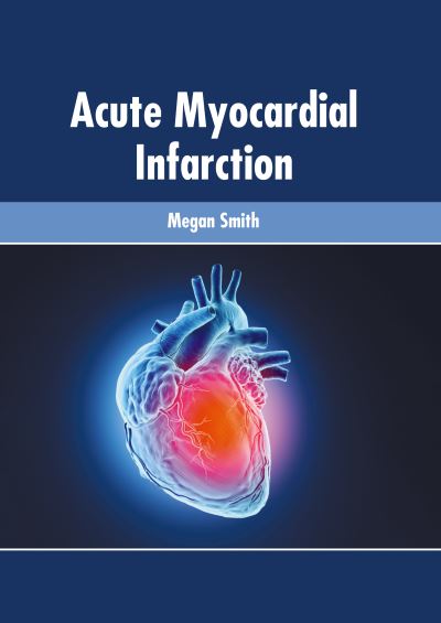 Cover for Megan Smith · Acute Myocardial Infarction (Gebundenes Buch) (2022)