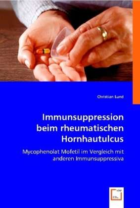 Cover for Lund · Immunsuppression beim rheumat. (Book)