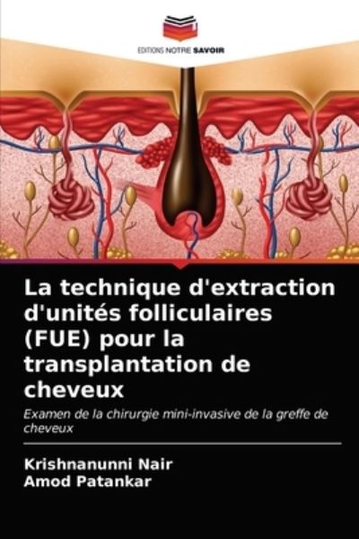 Cover for Krishnanunni Nair · La technique d'extraction d'unites folliculaires (FUE) pour la transplantation de cheveux (Paperback Book) (2021)