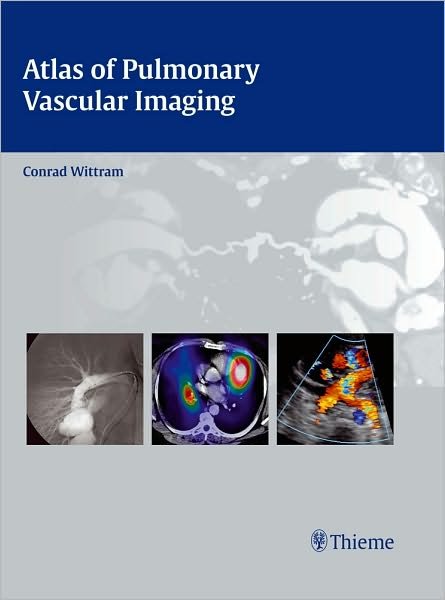 Atlas of Pulmonary Vascular Imaging - Conrad Wittram - Books - Thieme Medical Publishers Inc - 9781604063127 - September 3, 2010