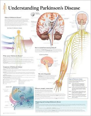 Understanding Parkinson's Laminated Poster - Scientific Publishing - Gadżety - Scientific Publishing - 9781932922127 - 1 września 2007