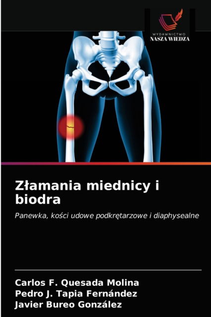 Cover for Carlos F Quesada Molina · Zlamania miednicy i biodra (Paperback Book) (2021)