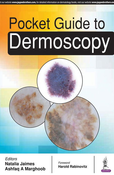 Cover for Natalia Jaimes · Pocket Guide to Dermoscopy (Taschenbuch) (2017)