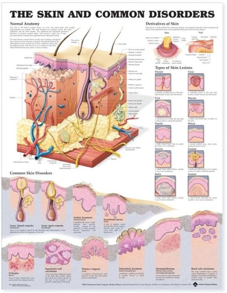 Cover for Anatomical Chart Com · The Skin and Common Disorders Anatomical Chart (Kartor) (2004)