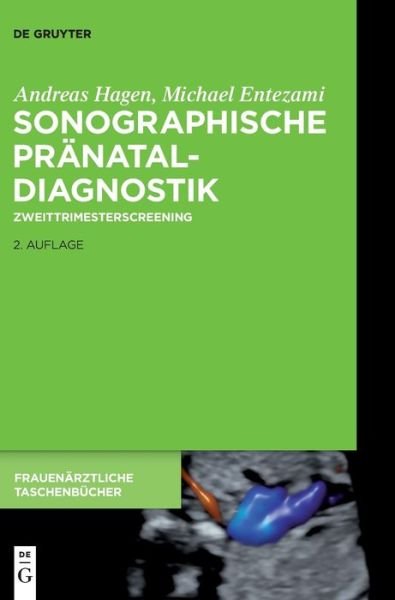 Cover for Entezami, Michael, M.D. · Sonographische Pranataldiagnostik: Zweittrimesterscreening - Frauenarztliche Taschenbucher (Hardcover bog) [2. Aufl. edition] (2019)