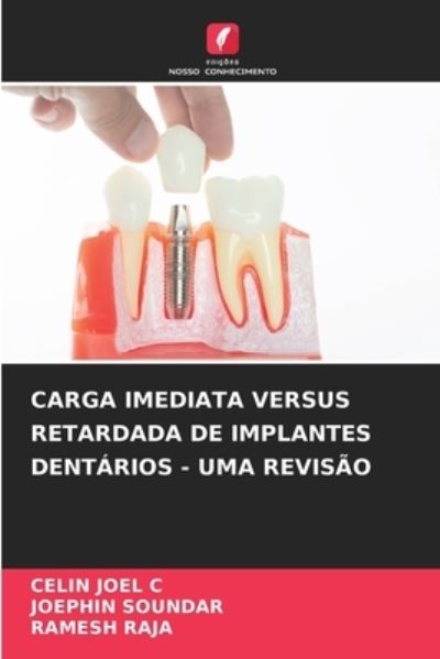 Cover for Celin Joel C · Carga Imediata Versus Retardada de Implantes Dentarios - Uma Revisao (Paperback Book) (2021)