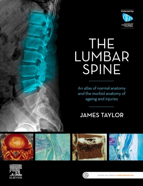 The Lumbar Spine: An Atlas of Normal Anatomy and the Morbid Anatomy of Ageing and Injury - James Taylor - Livros - Elsevier Australia - 9780729543132 - 25 de outubro de 2022