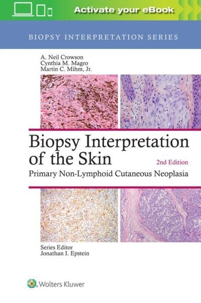 Cover for A. Neil Crowson · Biopsy Interpretation of the Skin: Primary Non-Lymphoid Cutaneous Neoplasia - Biopsy Interpretation Series (Innbunden bok) (2018)