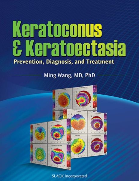 Keratoconus and Keratoectasia: Prevention, Diagnosis, and Treatment - Wang, Ming, M.D., Ph.D. - Books - SLACK  Incorporated - 9781556429132 - October 1, 2009