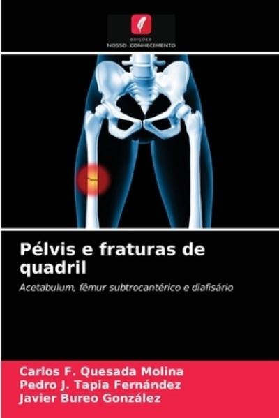 Cover for Carlos F. Quesada Molina · Pélvis e fraturas de quadril (Paperback Book) (2021)