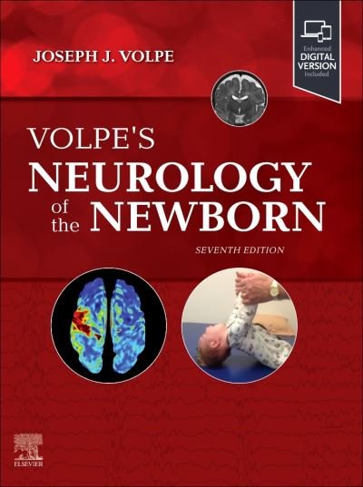 Volpe's Neurology of the Newborn (Innbunden bok) (2024)