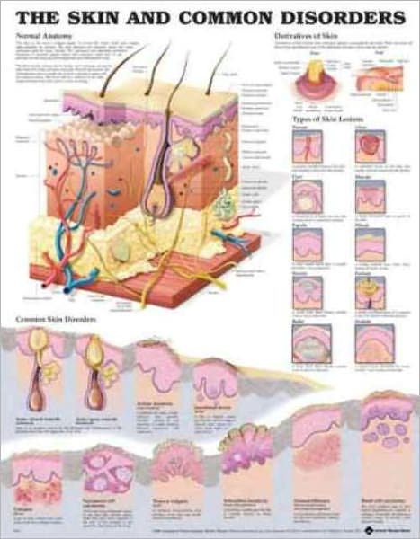 The Skin and Common Disorders Anatomical Chart - Anatomical Chart Com - Books - Anatomical Chart Co. - 9781587796135 - January 31, 2004