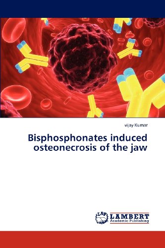 Bisphosphonates Induced Osteonecrosis of the Jaw - Vijay Kumar - Books - LAP LAMBERT Academic Publishing - 9783659322136 - January 11, 2013