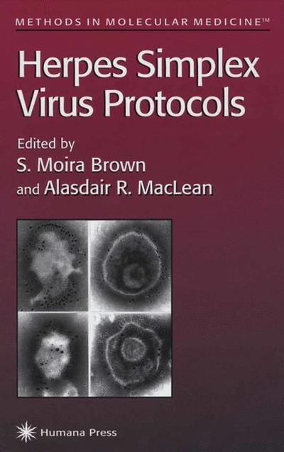 Cover for S Moira Brown · Herpes Simplex Virus Protocols - Methods in Molecular Medicine (Paperback Book) [1st ed. Softcover of orig. ed. 1998 edition] (2010)