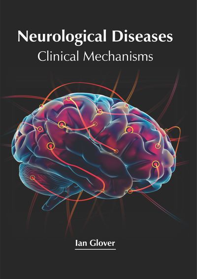 Cover for Ian Glover · Neurological Diseases: Clinical Mechanisms (Hardcover Book) (2019)