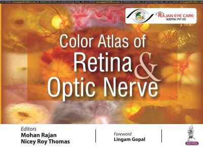 Cover for Mohan Rajan · Color Atlas of Retina &amp; Optic Nerve (Inbunden Bok) (2022)