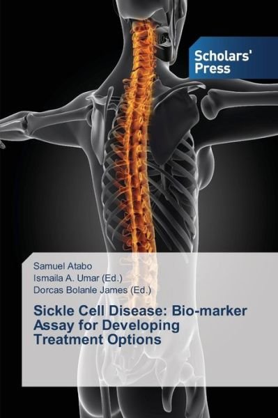 Cover for Atabo Samuel · Sickle Cell Disease: Bio-marker Assay for Developing Treatment Options (Paperback Book) (2015)