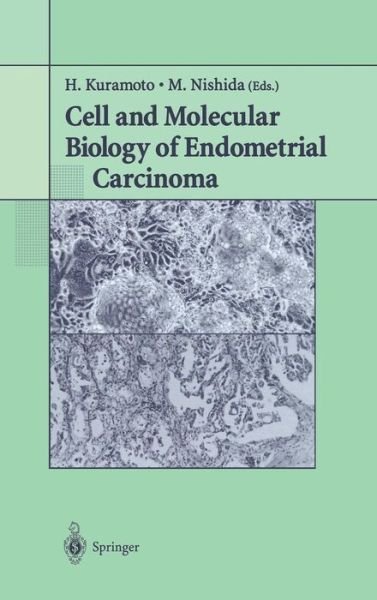 Hiroyuki Kuramoto · Cell and Molecular Biology of Endometrial Carcinoma (Gebundenes Buch) [2003 edition] (2003)