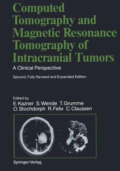 Cover for C. Claussen · Computed Tomography and Magnetic Resonance Tomography of Intracranial Tumors: A Clinical Perspective (Paperback Book) [2nd ed. 1989. Softcover reprint of the original 2n edition] (2011)