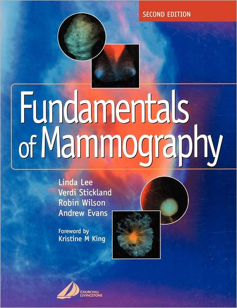 Cover for Sue Williams · Fundamentals of Mammography (Paperback Book) (2002)