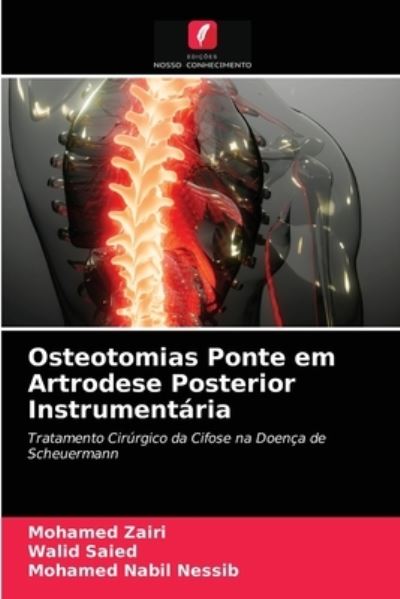 Cover for Mohamed Zairi · Osteotomias Ponte em Artrodese Posterior Instrumentaria (Paperback Book) (2021)